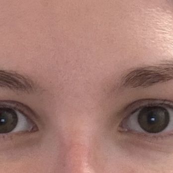 Illume Brow & Skin Studio - Before - Skin Care Near Me - Chicago, Illinois Illume Brow & Skin Studio - Before - Skin Care Near Me - Chicago, Illinois