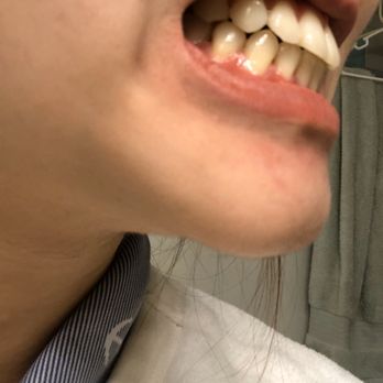 Summit Orthodontics - Orthodontists Near Me - Rancho Cucamonga, California