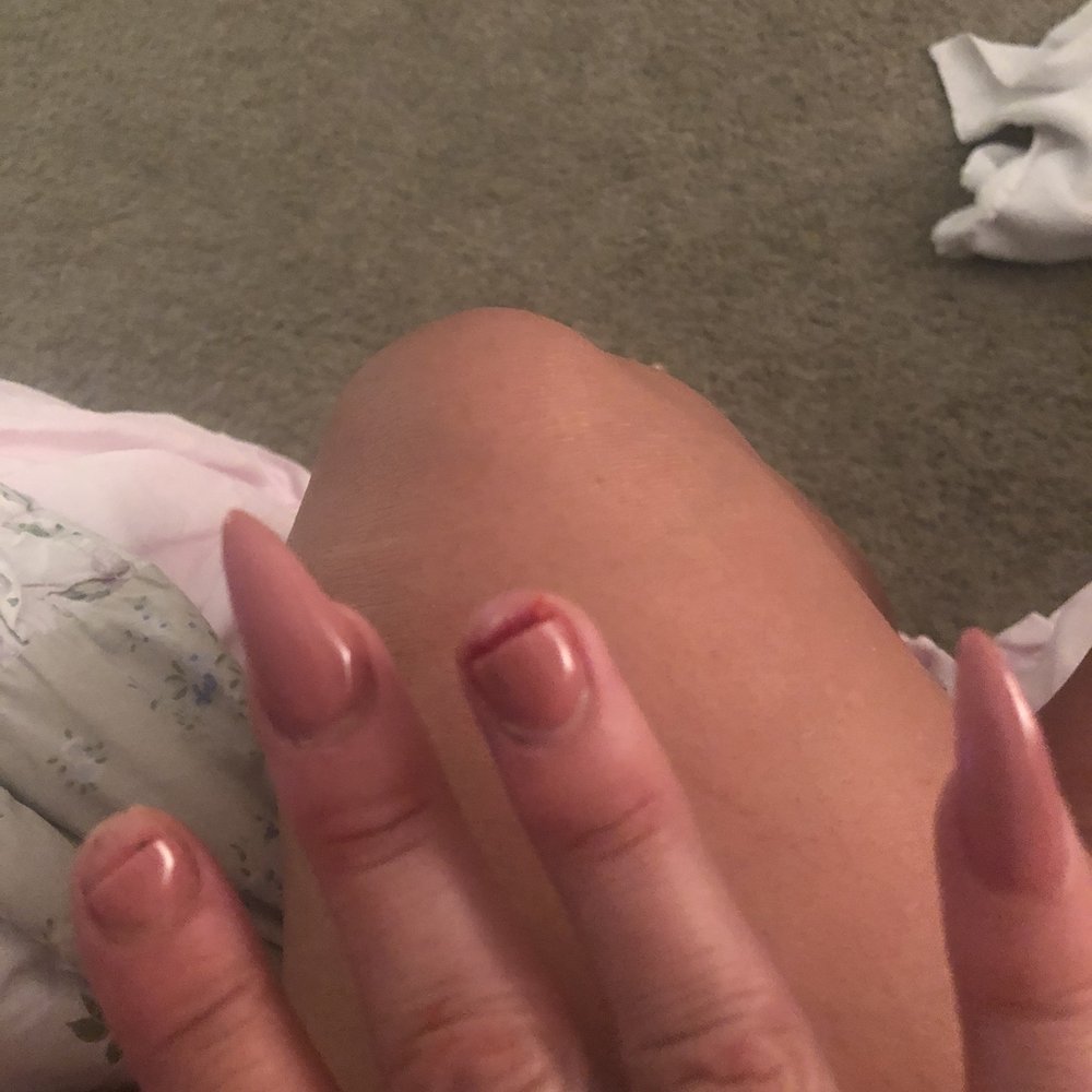 Venetian Nail Spa - My nails broken and bloody - Nail Salons Near Me - Plano, Texas