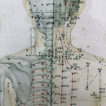 Simon Tang - Traditional Chinese Medicine Near Me - Oakland, California