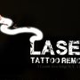 Photo of Ink Cemetery Laser Tattoo Removal