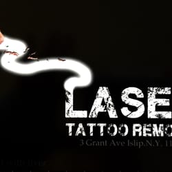 Ink Cemetery Laser Tattoo Removal