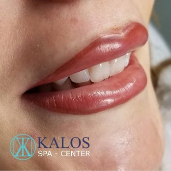 Kalos Spa Center - Great opportunity to correct the lips shape or the lips color. Different solutions are possible - Skin Care Near Me - Miami, Florida Kalos Spa Center - Great opportunity to correct the lips shape or the lips color. Different solutions are possible - Skin Care Near Me - Miami, Florida
