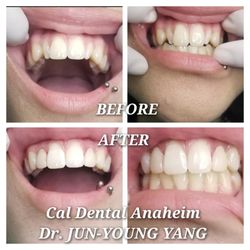Cal Dental Anaheim - Cal Dental Anheim
3006 W LINCONLN AVE
ANAHEIM, CA 92801
(714) 828 0508