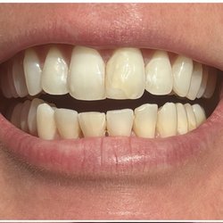 Centennial Hills Dental Care - Original smile