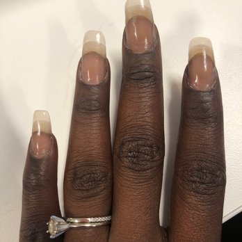 Nails U Love - See the uneven nails? The old polish still visible on my cuticles? See how my cuticles don't even look clipped or trimmed? - Skin Care Near Me - Long Beach, California Nails U Love - See the uneven nails? The old polish still visible on my cuticles? See how my cuticles don't even look clipped or trimmed? - Skin Care Near Me - Long Beach, California