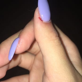 Today's Nail Spa - cuts on nails from the mechanical filer - Nail Salons Near Me - Simi Valley, California Today's Nail Spa - cuts on nails from the mechanical filer - Nail Salons Near Me - Simi Valley, California