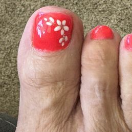 Horrible peficure