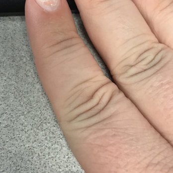 Nails Charm - Dip nails peeling/chipping after 10 days - Nail Salons Near Me - Orange, California Nails Charm - Dip nails peeling/chipping after 10 days - Nail Salons Near Me - Orange, California