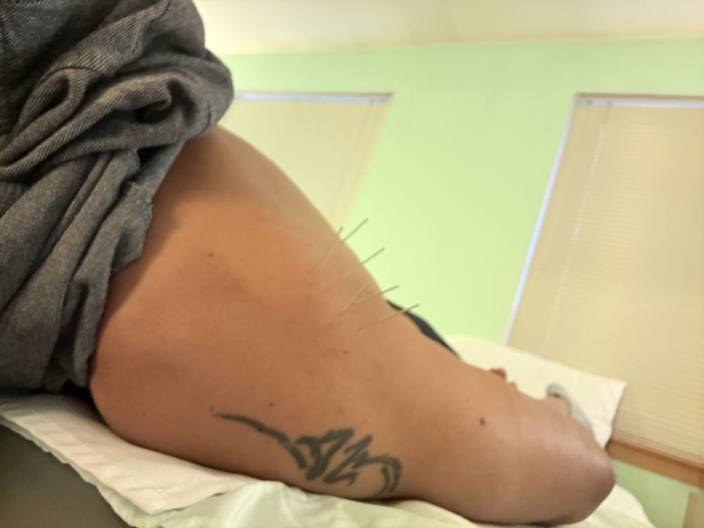 Green Point Acupuncture