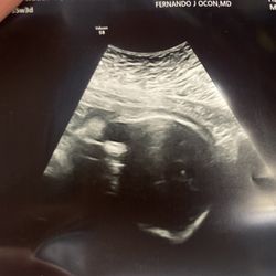 Women's Health Specialist of Pasadena - This is supposedly my baby's "face" does anyone see a face here!?.