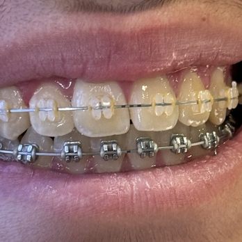 Sunga Orthodontics - Braces - Orthodontists Near Me - Chula Vista, California Sunga Orthodontics - Braces - Orthodontists Near Me - Chula Vista, California