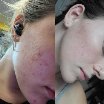 Skin Secure Aesthetics - Customizable Facial Package - Estheticians Near Me - Boca Raton, Florida Skin Secure Aesthetics - Customizable Facial Package - Estheticians Near Me - Boca Raton, Florida