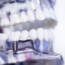 Valley Oral Surgery