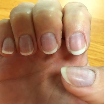 Vip Nails - Left with my nails looking like this and without a refund. - Nail Salons Near Me - Dubuque, Iowa