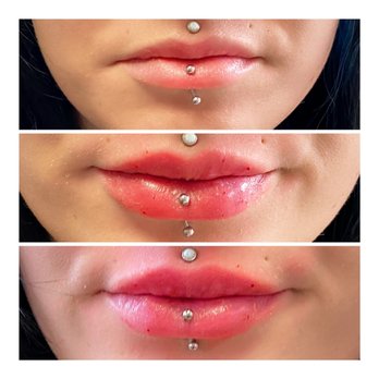 Glamoureyez - Lip filler - Eyelash Service Near Me - Westminster, Colorado Glamoureyez - Lip filler - Eyelash Service Near Me - Westminster, Colorado