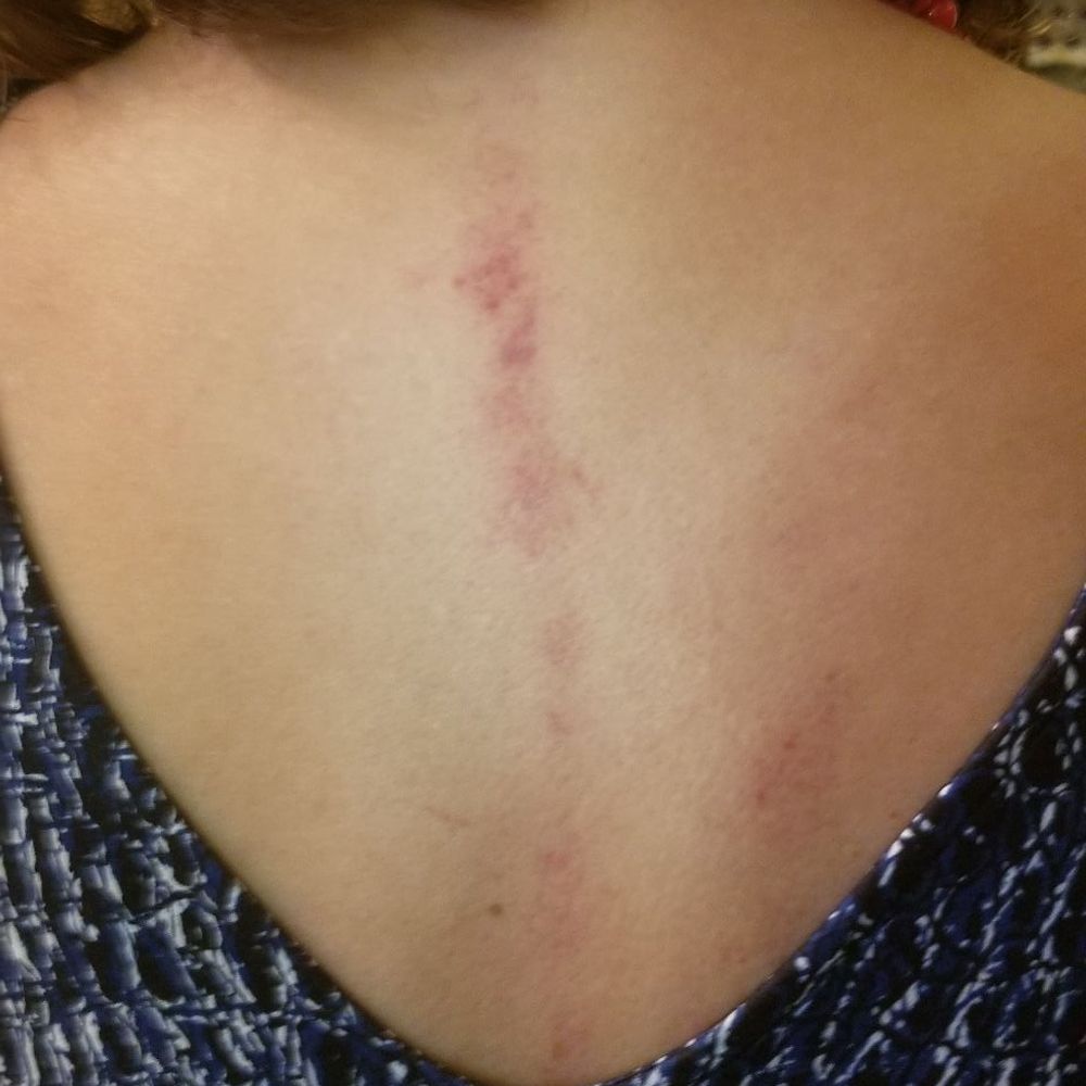 Asian Royal Spa - My spine after massage. - Beauty & Spas Near Me - Riverwoods, Illinois