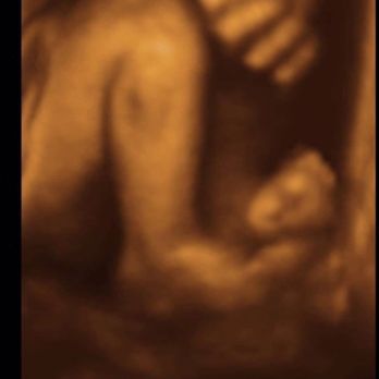 InnerView Ultrasound - Leg and foot with hand - Ultrasound Imaging Centers Near Me - Malvern, Pennsylvania InnerView Ultrasound - Leg and foot with hand - Ultrasound Imaging Centers Near Me - Malvern, Pennsylvania