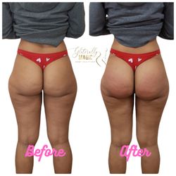 Gliterally Magic Body Sculpting