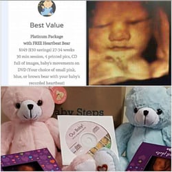 Baby Steps Ultrasound