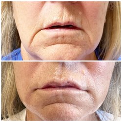 EnvisionU Innovative Aesthetics - Lips