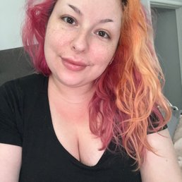 Lip filler and lip flip done by Cindy! Lip filler and lip flip done by Cindy!