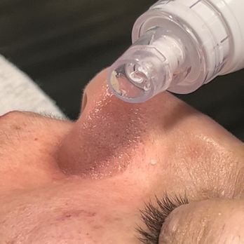 Bella Diosa Beauty - Hydro facial deeply cleanses and removes all impurities - Permanent Makeup Near Me - Albuquerque, New Mexico