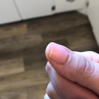 Xpressions Salon - And the first nail that's completely ruined...7 days later. - Hair Salons Near Me - Boise, Idaho Xpressions Salon - And the first nail that's completely ruined...7 days later. - Hair Salons Near Me - Boise, Idaho