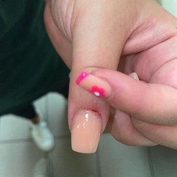 Bleeding?!? Gross! Bleeding?!? Gross!