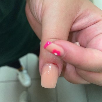 Luxury Nails and Spa - Bleeding?!? Gross! - Nail Salons Near Me - Vero Beach, Florida Luxury Nails and Spa - Bleeding?!? Gross! - Nail Salons Near Me - Vero Beach, Florida