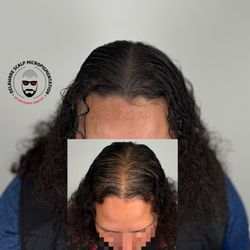 Delaware Scalp Micropigmentation - Delaware SMP offers realistic, non-surgical hair loss solutions for men. Look sharp, feel confident, stay bold.