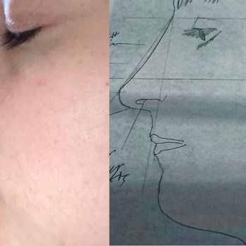 Aesthetx - Cosmetic Surgeons Near Me - Campbell, California
