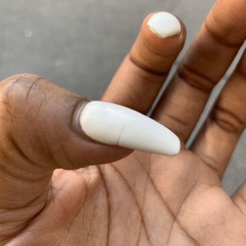 Angels Nails & Spa - Every nail cracked like this so fucking painful - Nail Salons Near Me - Chico, California