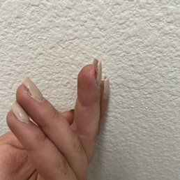 The cut I got from the man doing my nails, after he already hurt me and I asked him to be more gentle The cut I got from the man doing my nails, after he already hurt me and I asked him to be more gentle