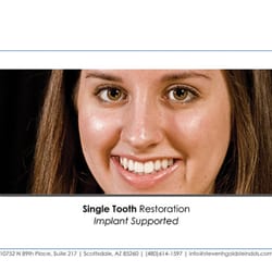 Steven H Goldstein, DDS - Smile Gallery, Single Tooth Dental Restorations, Dental Implant, Smile Makeover, Pretty Smiles
