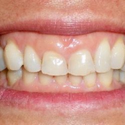Casey M Herrera, DDS - BEFORE