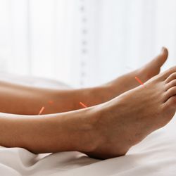Nest Acupuncture & Wellness Center