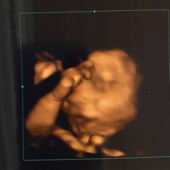 Next Generation Prenatal Imaging - Ultrasound Imaging Centers Near Me - Elk Grove, California Next Generation Prenatal Imaging - Ultrasound Imaging Centers Near Me - Elk Grove, California