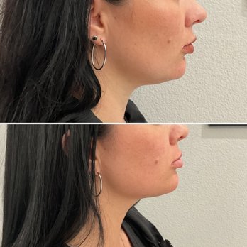 Magnetic Aesthetics - Medical Spas Near Me - Reno, Nevada Magnetic Aesthetics - Medical Spas Near Me - Reno, Nevada