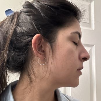 Skin By Nayra G - After - Skin Care Near Me - Downey, California Skin By Nayra G - After - Skin Care Near Me - Downey, California