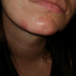 Nirvana - Before and after. I was happy that Tuesday for obvious reasons but that changed after my wax appointment.
