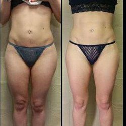 A Slimmer You