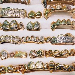 Gold Fever - Custom made gold fronts