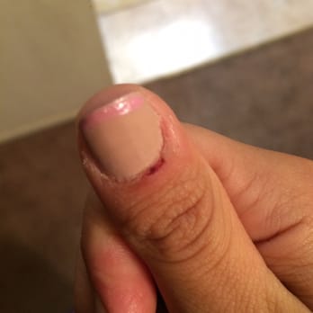 Sky Nails Spa - How do you cut a 12 year old's cuticle so bad it makes her bleed and scab?! - Nail Salons Near Me - San Carlos, California