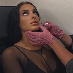 Serenity Salon & Spa - Lip filler plus botox offered by Katie and Jamie!
