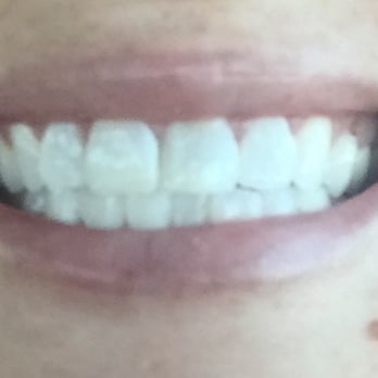 Louis Cohen, DDS - Thank you Dr. Cohen and Faye for bringing my smile back to life! Dr. Cohen has been my dentist for almost a decade and I love his office! - General Dentistry Near Me - Santa Ana, California