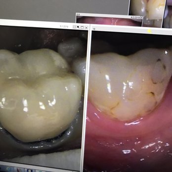 Gary Arabatyan, DDS - Sutter Dental - Before and after - General Dentistry Near Me - San Francisco, California