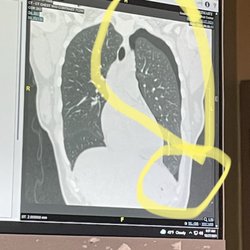 TriStar Southern Hills Medical Center - X-ray