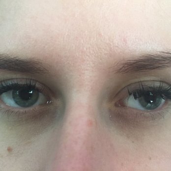 Pampers Beauty - Extensions sticking in my eye . Wrong application and lots of pain. - Massage Near Me - Edmonton, Alberta Pampers Beauty - Extensions sticking in my eye . Wrong application and lots of pain. - Massage Near Me - Edmonton, Alberta