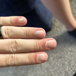 Lucky Nails - Next Day after peroxide and Neosporin. Cuts into pinky, middle, and pointer finger